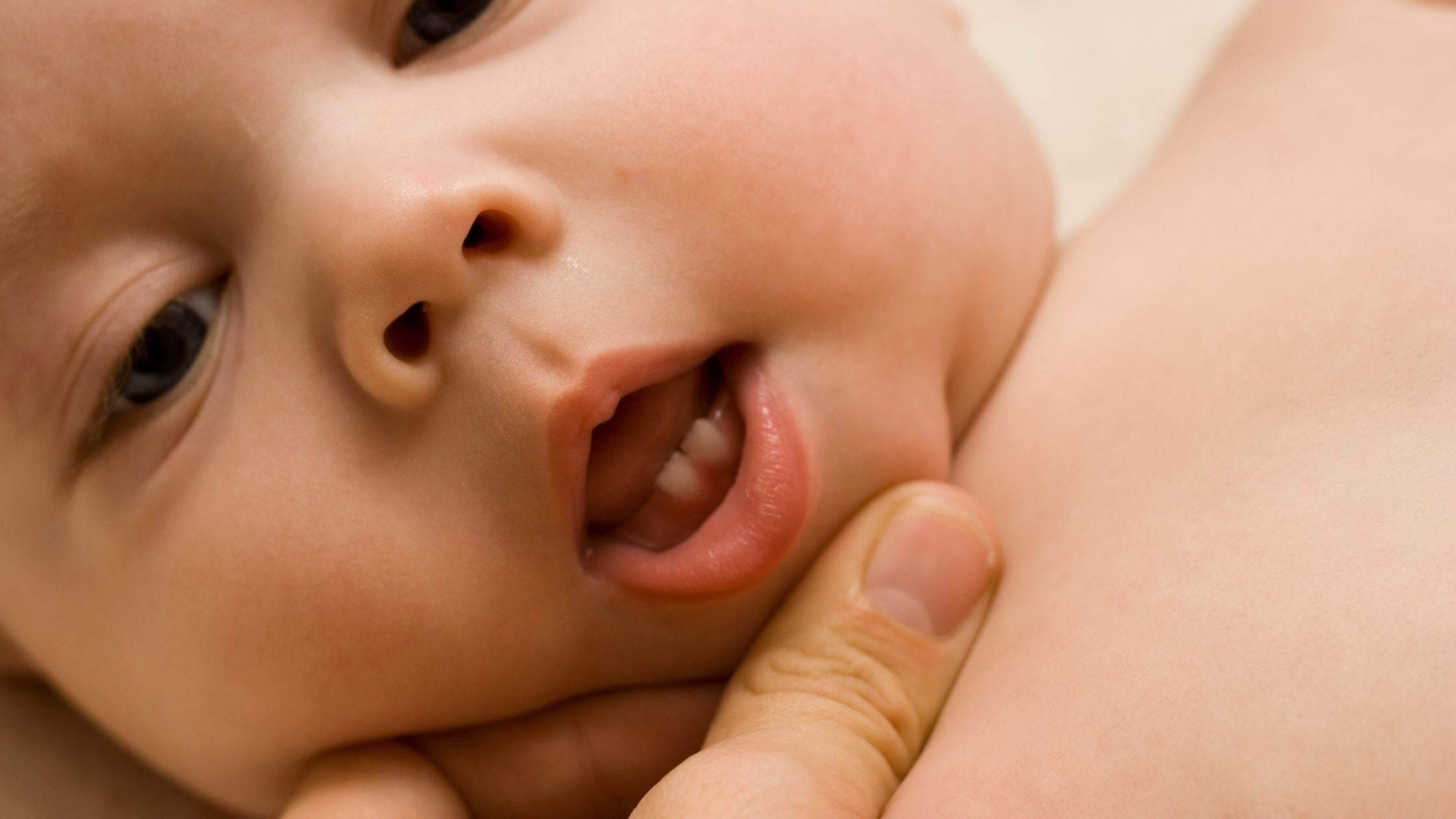 Can Teething Cause Eczema Flare-ups?