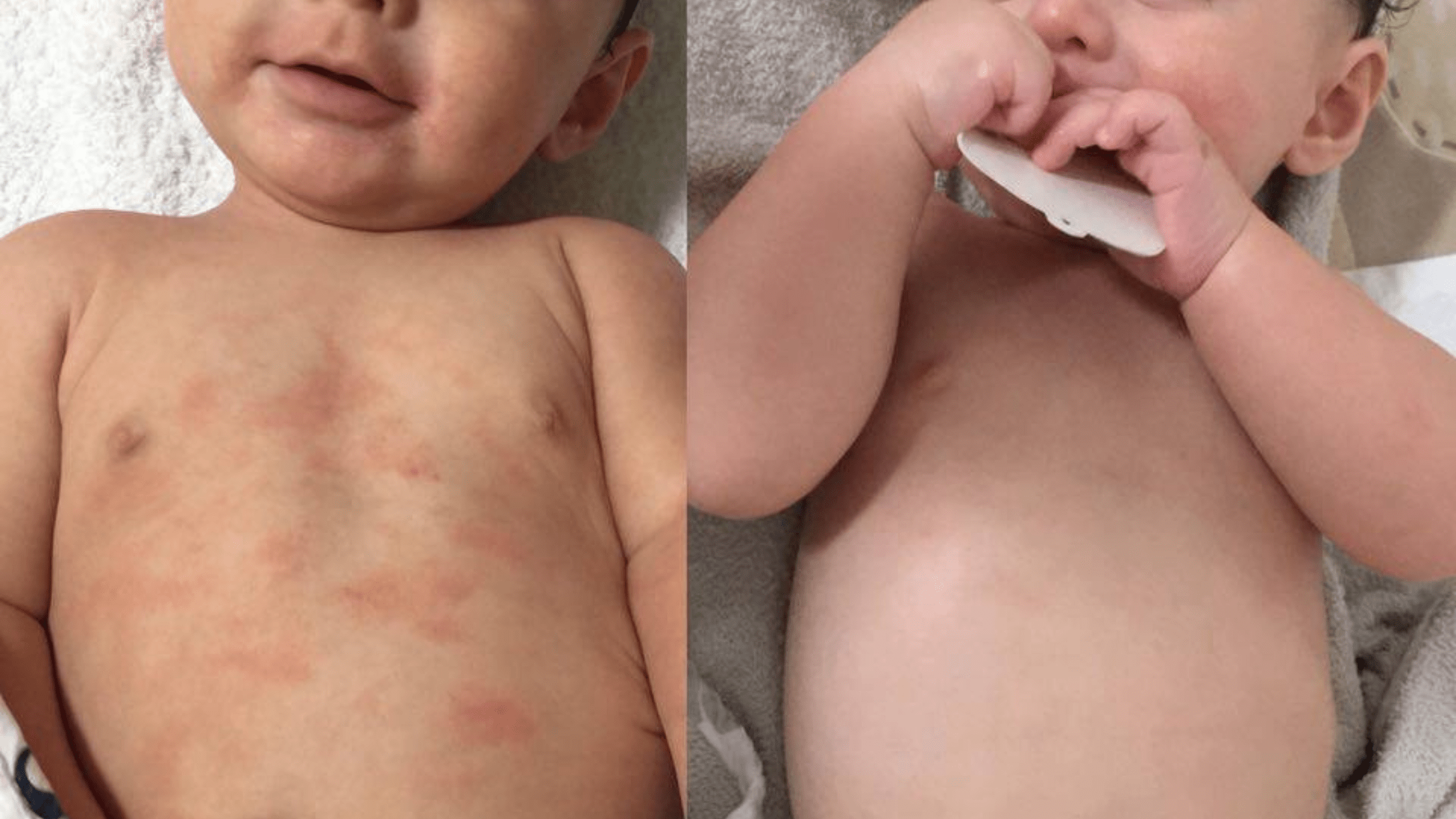 Soothing Itchy Skin