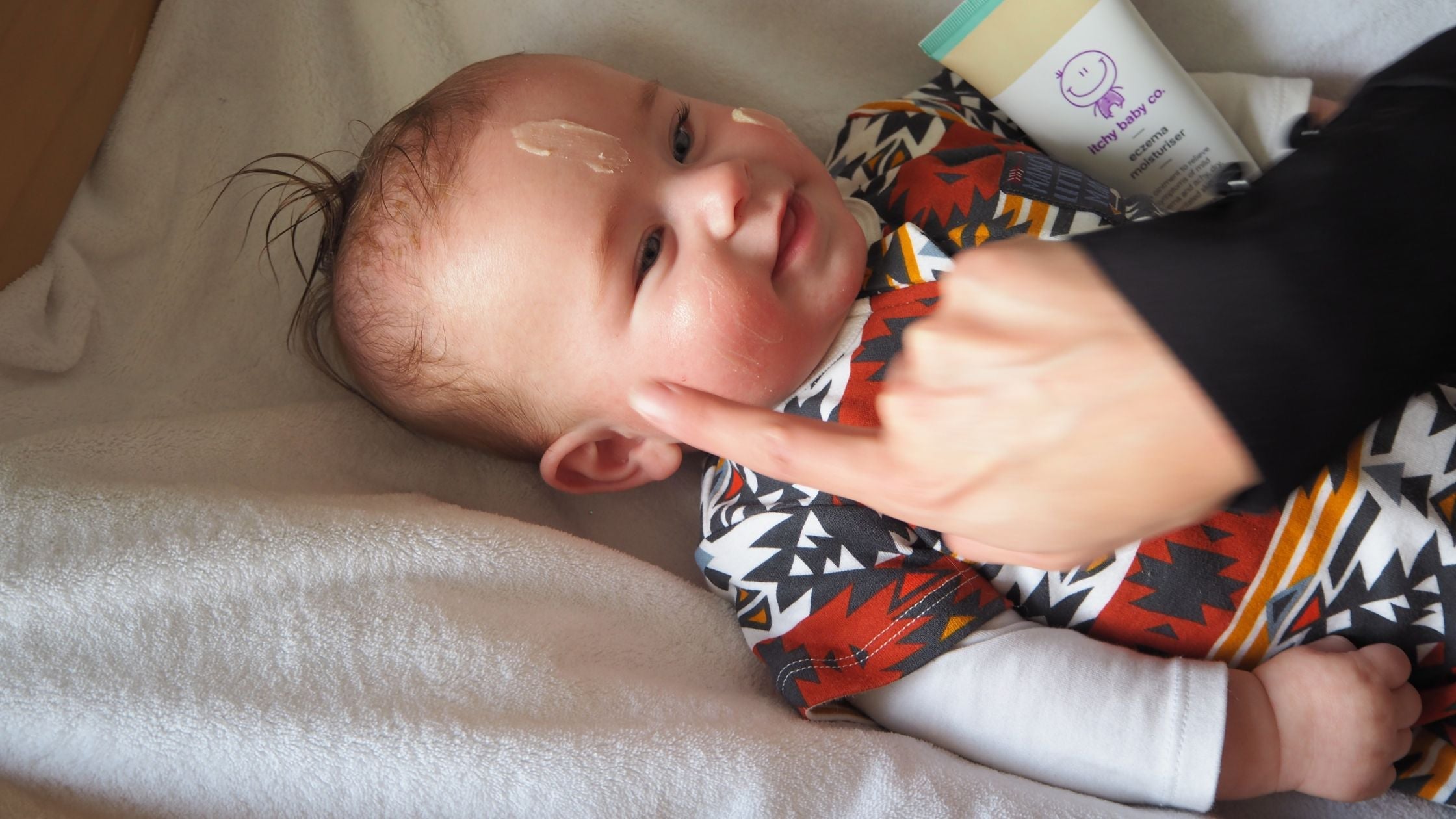 What Is Nummular Eczema and What Can I Do to Manage It?