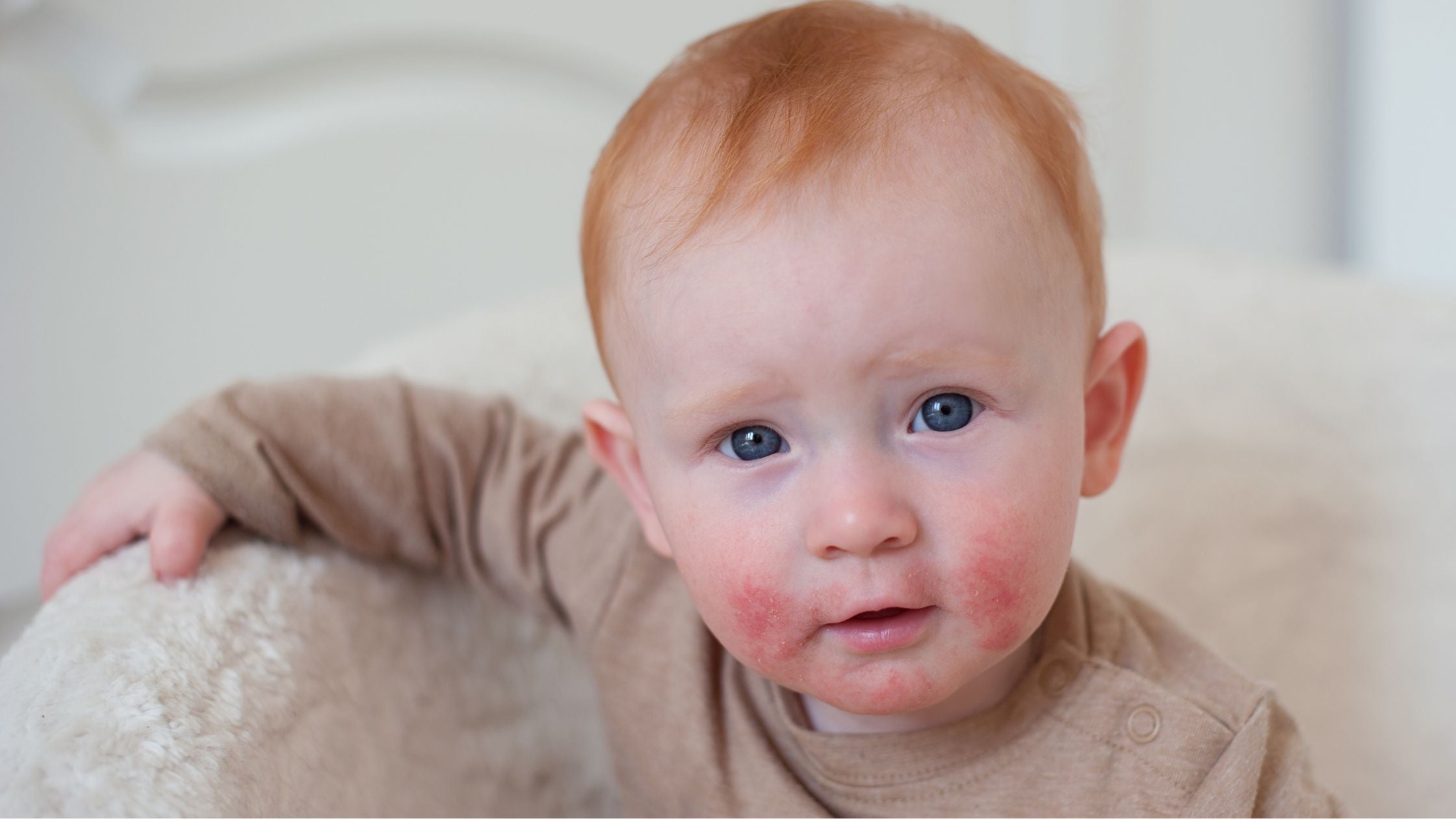 What’s the Difference Between Atopic Dermatitis and Contact Dermatitis?