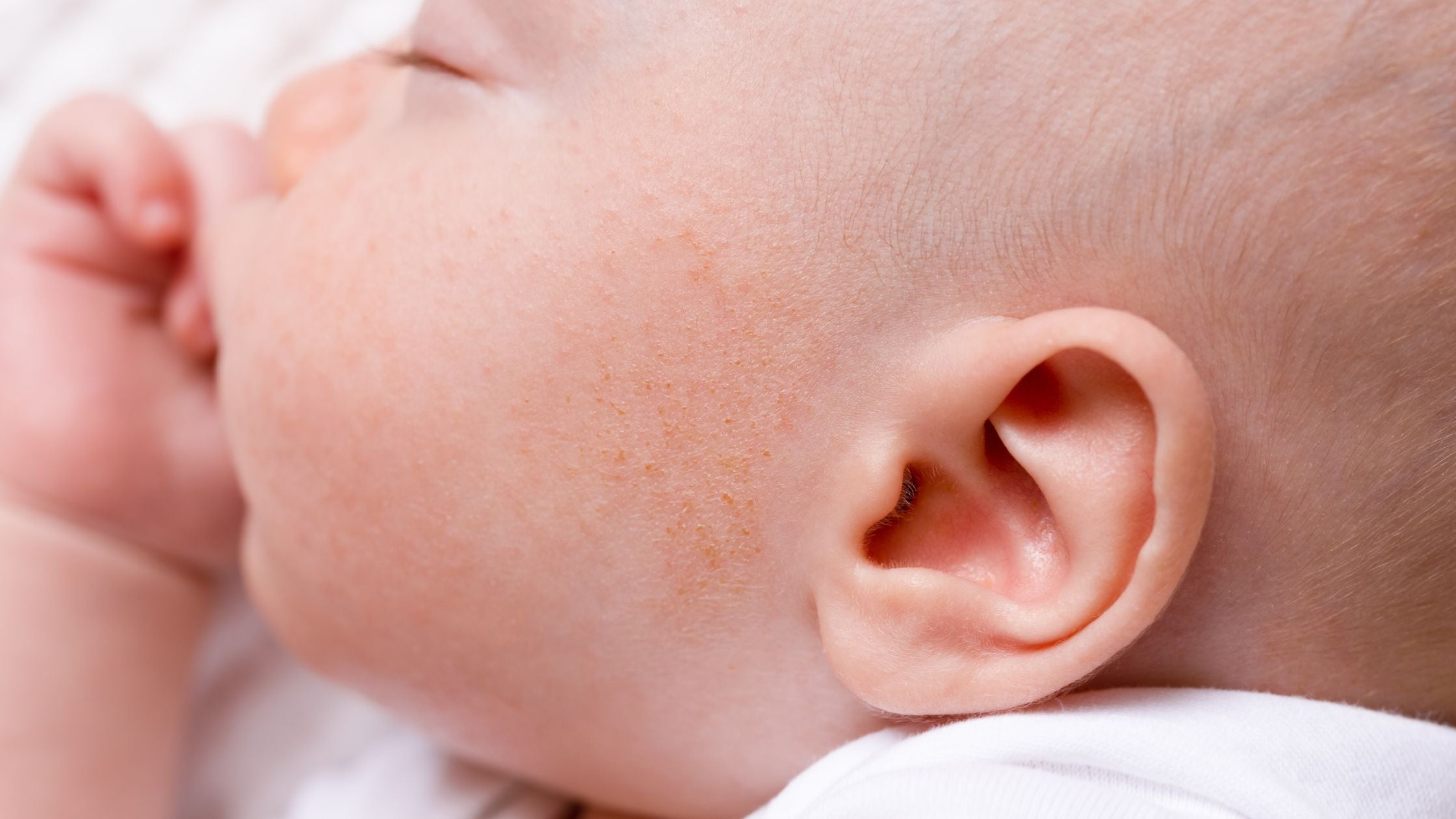 What's the Difference Between Eczema and Dermatitis?