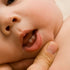 Can Teething Cause Eczema Flare-ups?