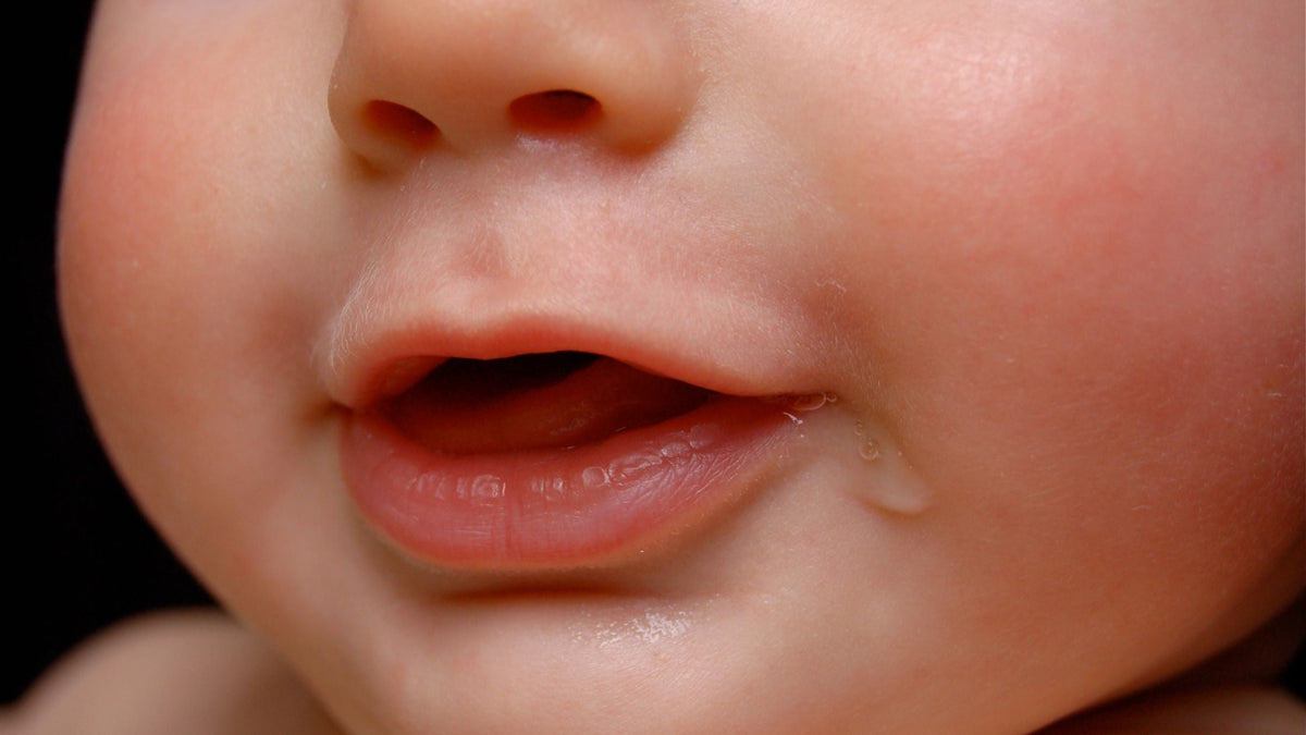 Drool Rash vs. Eczema: What's the Difference?– Itchy Baby Co.