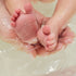 What Is Transepidermal Water Loss, and How Is It Linked to Eczema?